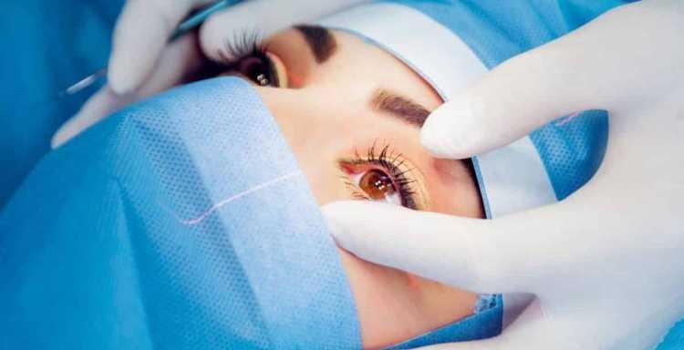 عمليات الليزك الآن أسهل وأسرع في مركز الدكتور محمد عبد الحليم